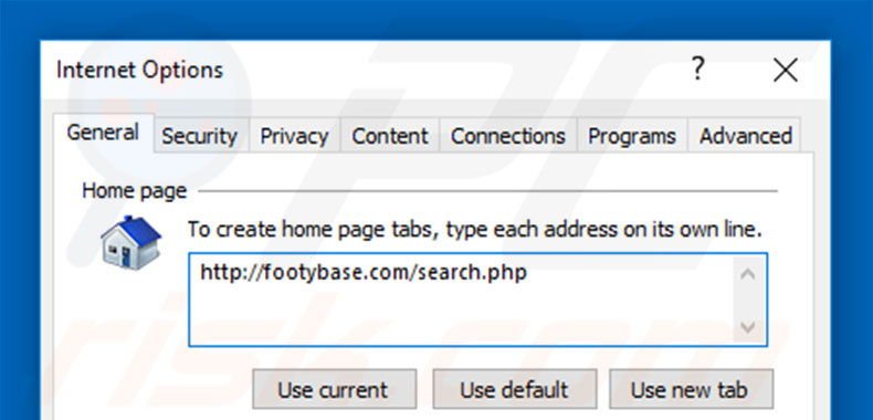 Suppression de la page d'accueil de footybase.com dans Internet Explorer 